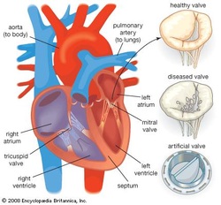 Artificial Valves for the Heart